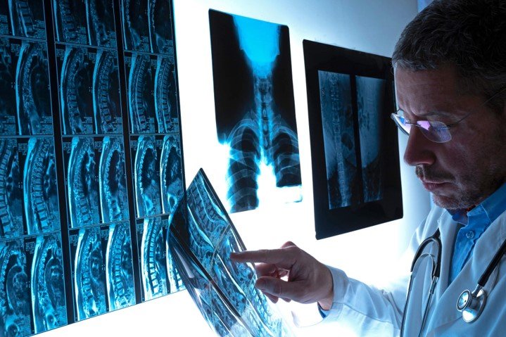 Physician in white coat reviewing spinal X-rays for surgery opinion in Dallas, TX
